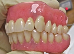 swiss dentures