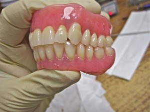 example of swiss denture